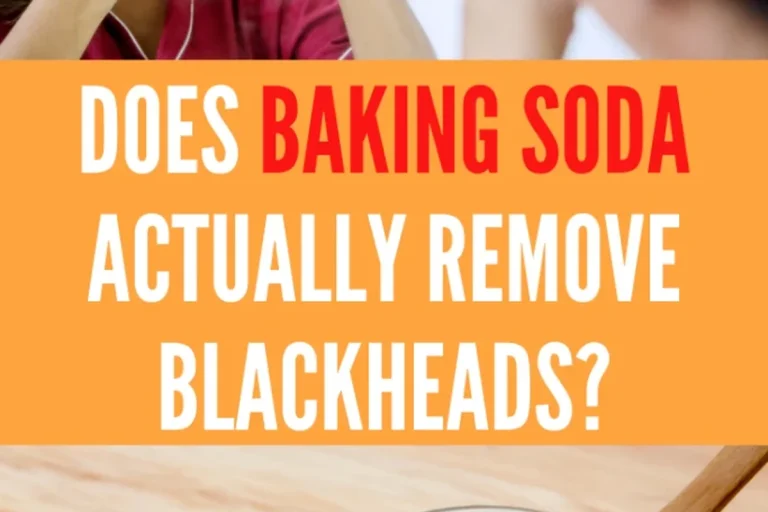 Baking Soda for Blackheads Does It Really Work