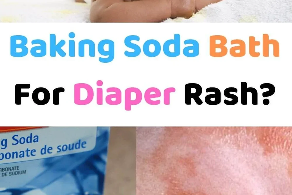Parent preparing a gentle baking soda bath for a baby with diaper rash