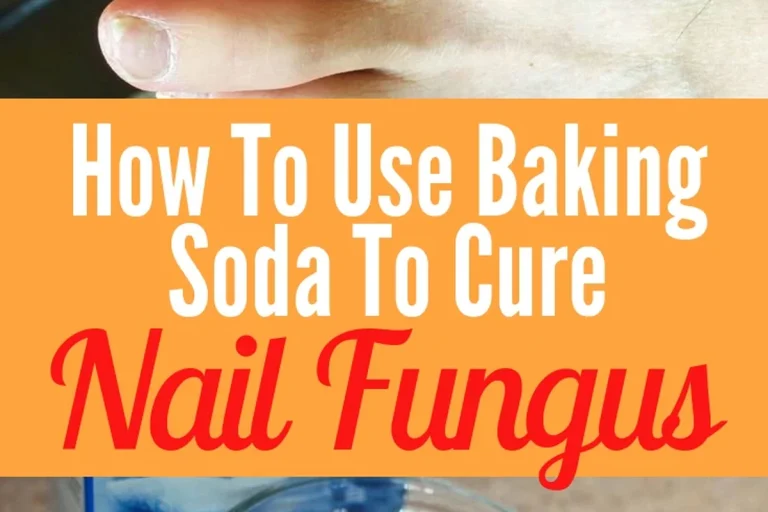 Baking Soda for Nail Fungus Does It Really Work