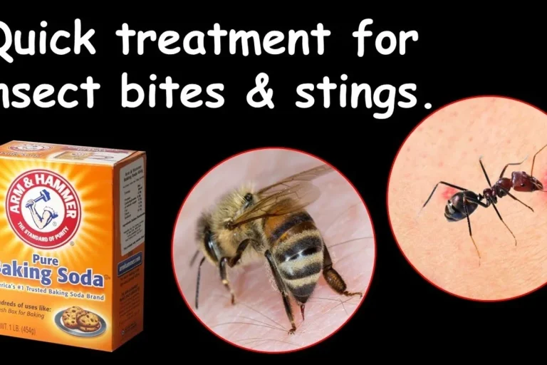Baking Soda Paste for Bug Bites Relief That Works Fast
