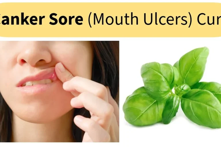 Baking Soda Paste for Canker Sores Relief That Works