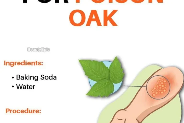 Baking Soda Paste for Poison Ivy Relief That Works