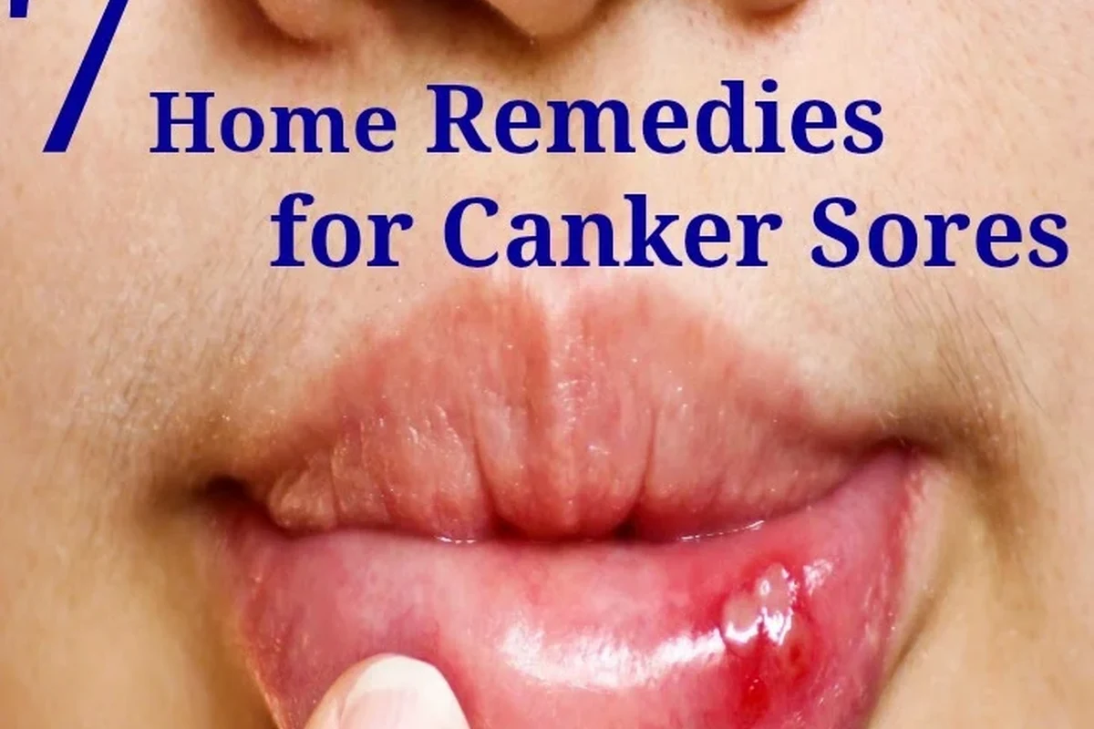 Person preparing a baking soda rinse in a cup for canker sore relief
