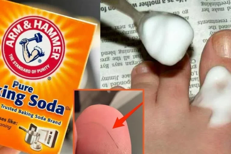Baking Soda for a Splinter Easy Removal Tips That Work