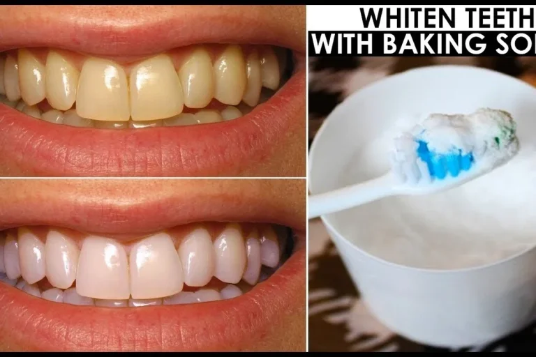 Does Baking Soda Whiten Teeth Safely and Effectively